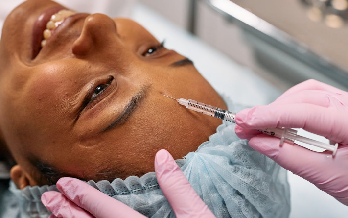 What to do After Microneedling?