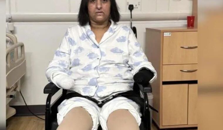 Woman Loses Both Hands and Legs After Dog Lick Leads to Sepsis