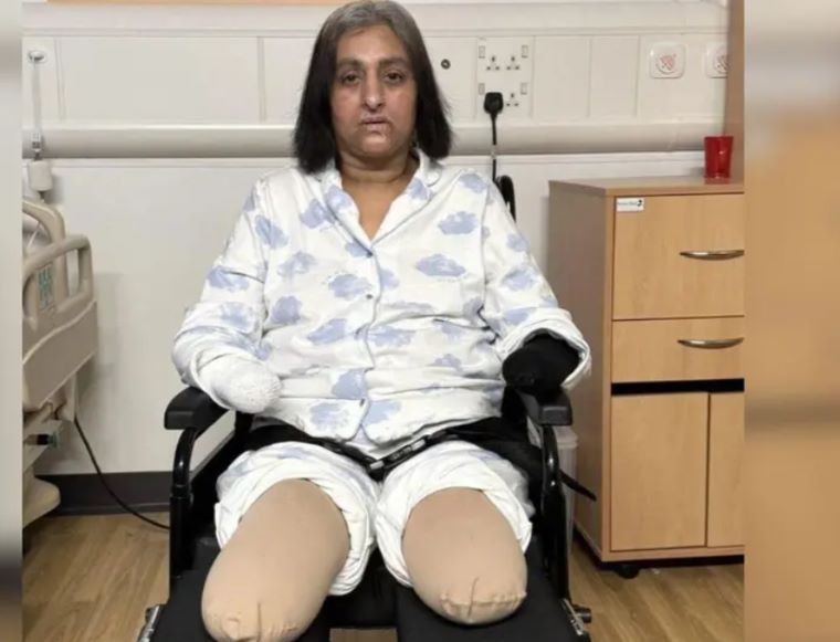 Woman Loses Both Hands and Legs After Dog Lick Leads to Sepsis