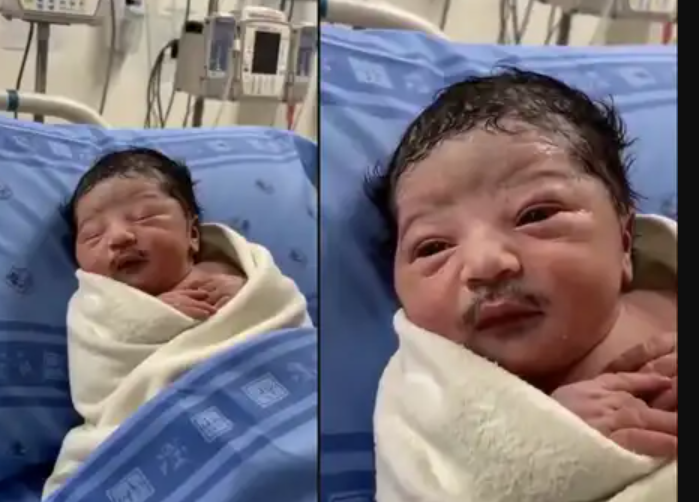 Baby Born With a Moustache? Viral Video Leaves the Internet Stunned!